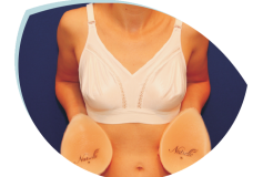 Augmentarea mamara, optiuni de incizie
